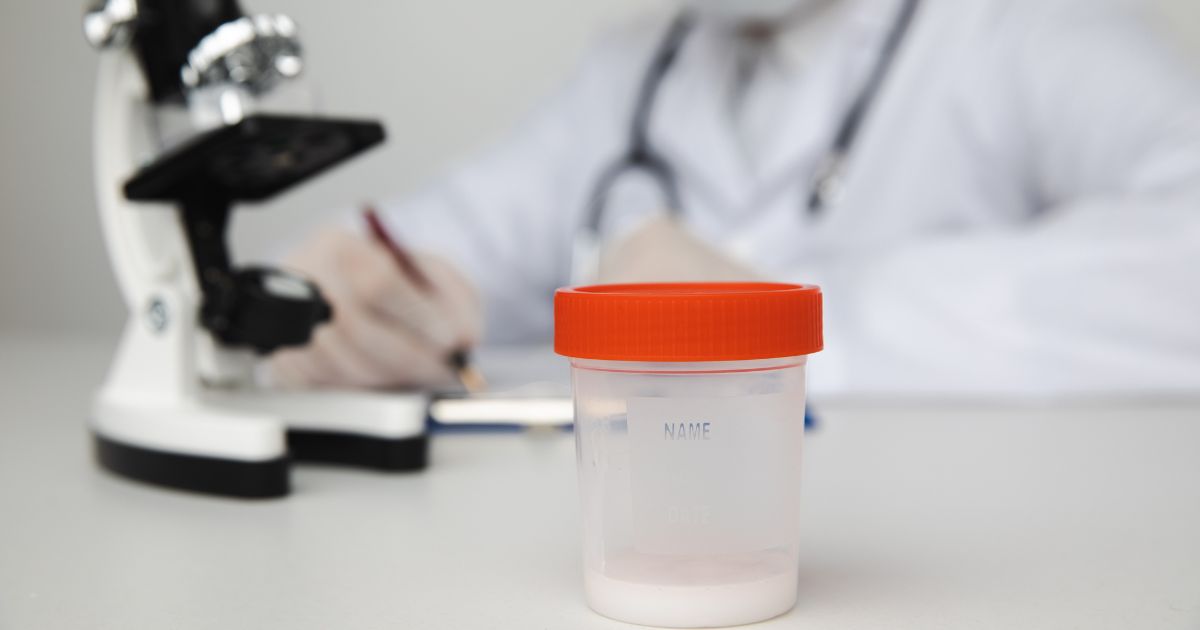 ako zlepsit spermiogram